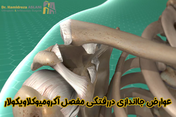 عوارض جااندازی دررفتگی مفصل آکرومیوکلاویکولار