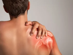 بیماری های شانه