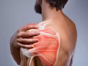 پارگی تاندون شانه