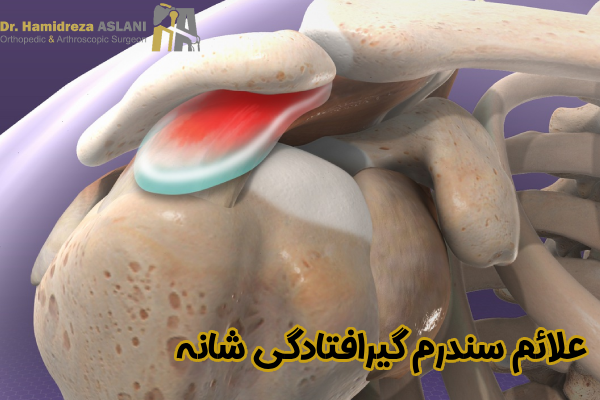 علائم گیرافتادگی شانه