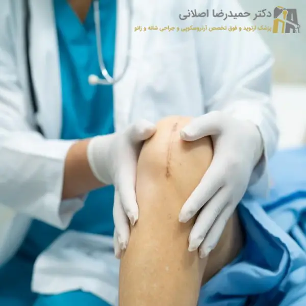 مزایای جراحی تعویض مفصل زانو