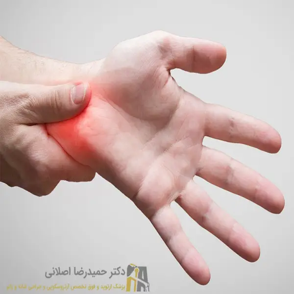 دلایل بروز سندرم کانال کارپ