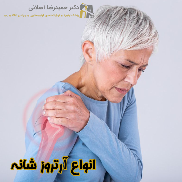 انواع آرتروز شانه