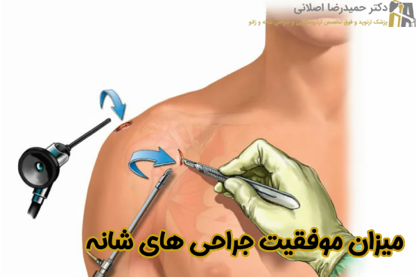 میزان موفقیت جراحی های شانه