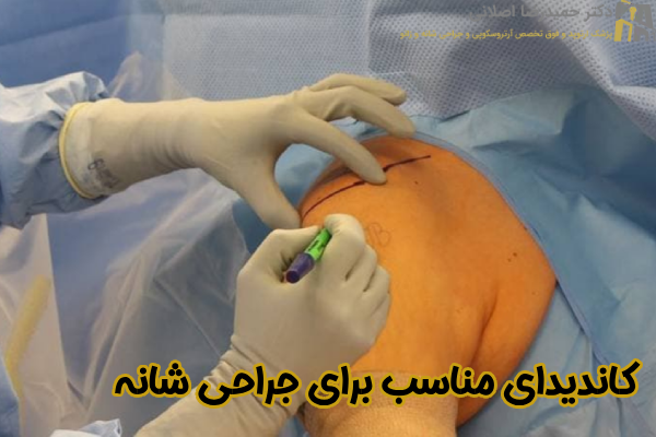 کاندیدای مناسب برای جراحی شانه