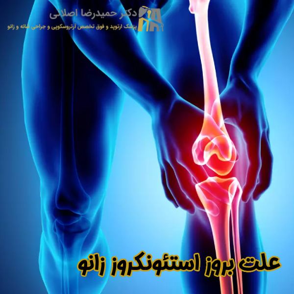 علت بروز استئونکروز زانو