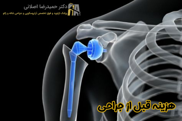هزینه قبل از جراحی تعویض مفصل شانه