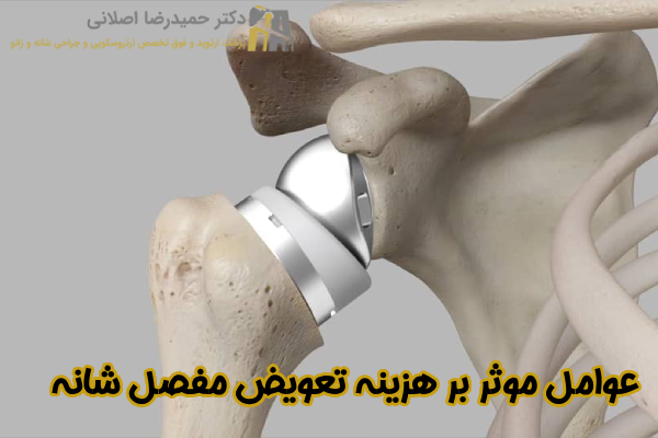 عوامل موثر بر هزینه تعویض مفصل شانه