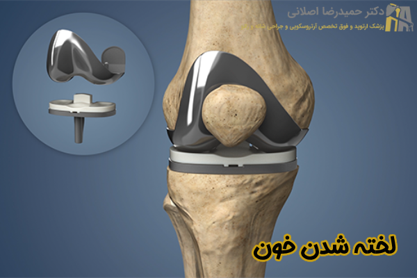 لخته شدن خون