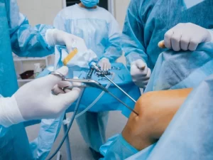 مراقبت بعد از آرتروسکوپی زانو