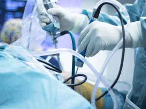 هزینه آرتروسکوپی زانو