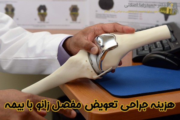 هزینه جراحی تعویض مفصل زانو با بیمه