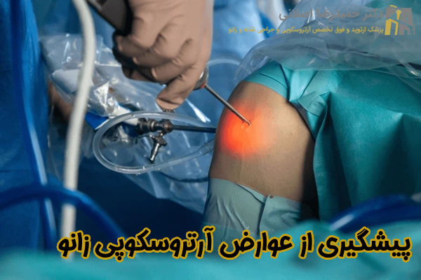 پیشگیری از عوارض آرتروسکوپی زانو