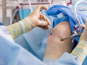 مراقبت بعد از جراحی مینیسک زانو