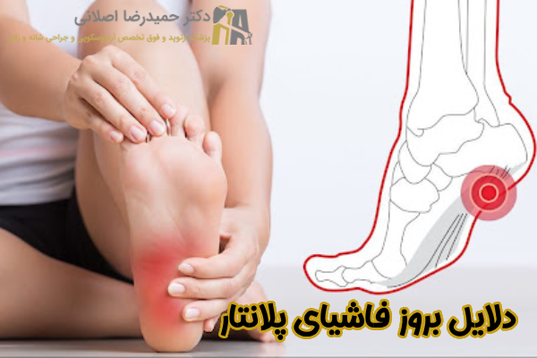 دلایل بروز فاشیای پلانتار