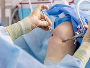 هزینه جراحی مینیسک زانو