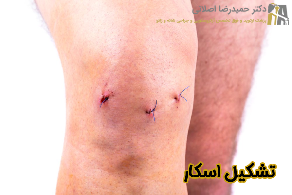 تشکیل اسکار