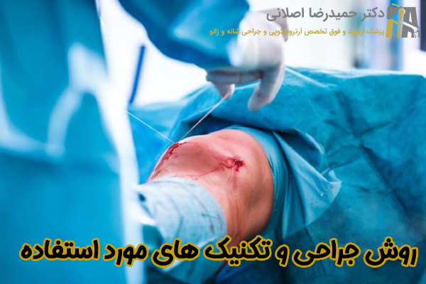 روش جراحی و تکنیک های مورد استفاده