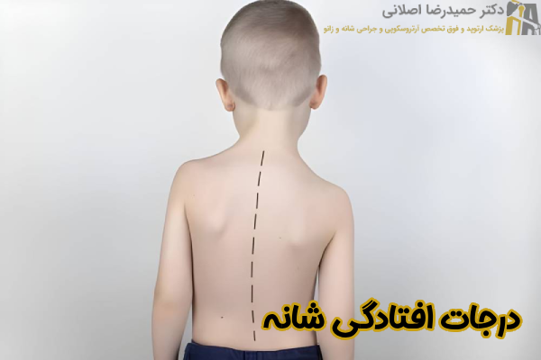 درجات افتادگی شانه