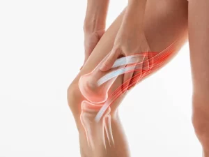 در رفتگی زانو