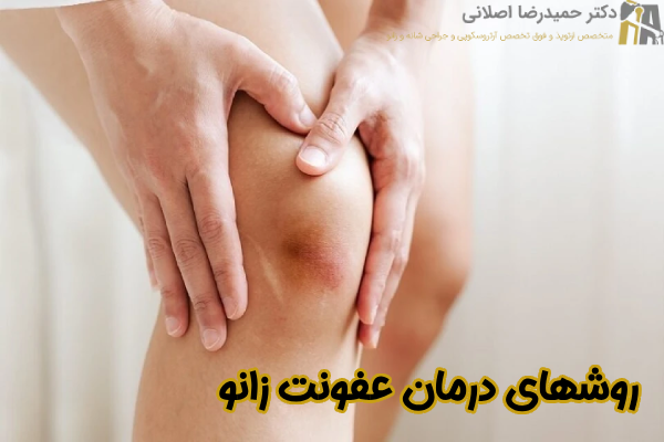 روشهای درمان عفونت زانو