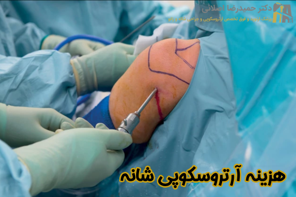 قیمت آرتروسکوپی شانه