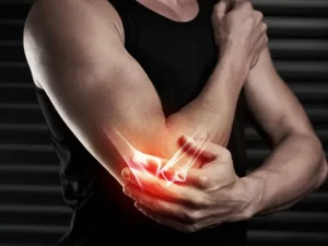 در رفتگی آرنج