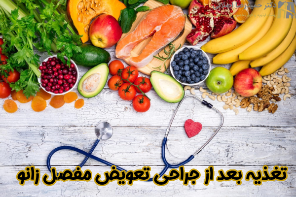 تغذیه بعد از تعویض مفصل زانو