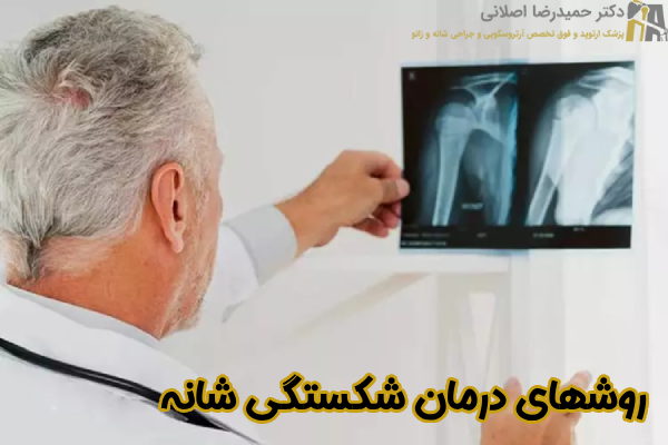روشهای درمان شکستگی شانه
