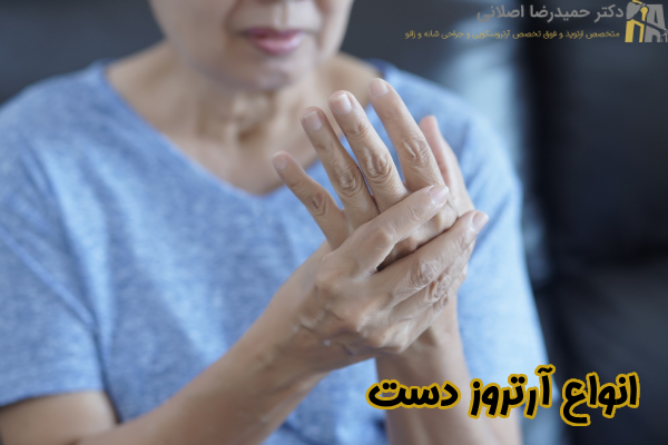 انواع آرتروز دست
