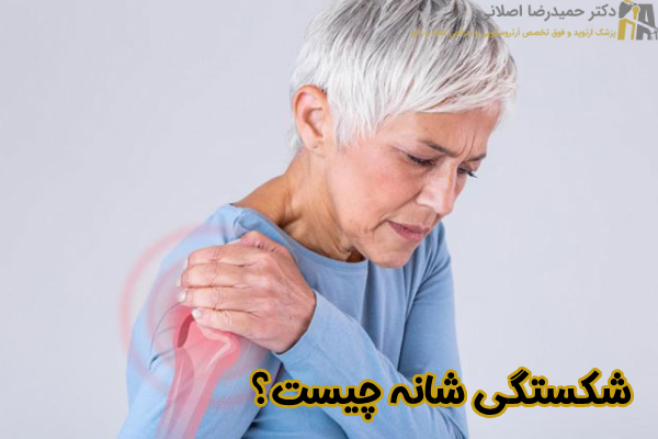 شکستگی شانه چیست