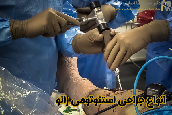 انواع جراحی استئوتومی زانو