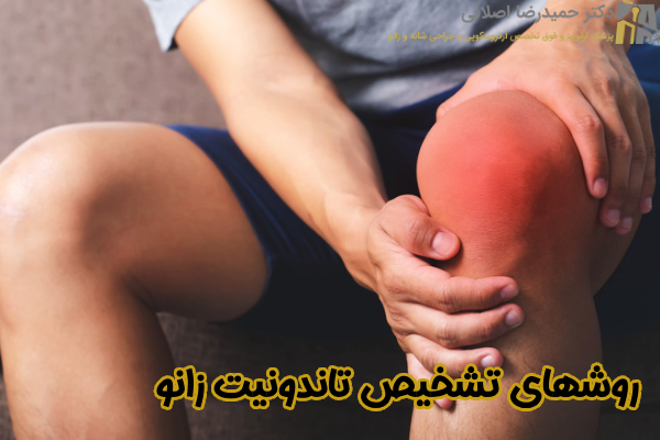 روشهای تشخیص تاندونیت زانو
