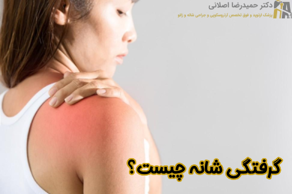 گرفتگی شانه چیست
