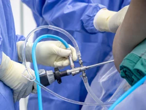 عوارض آرتروسکوپی شانه