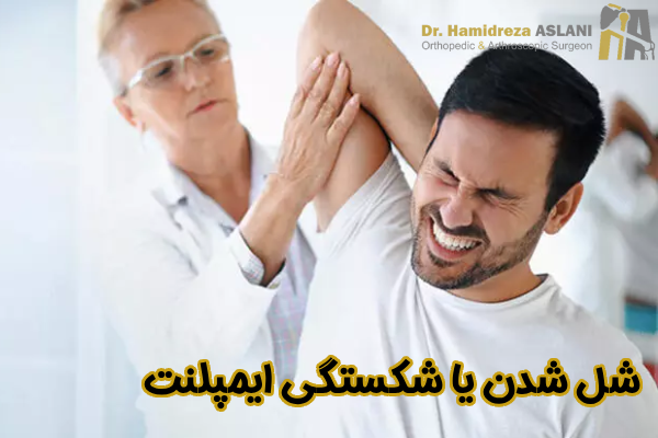 شکستگی ایمپلنت