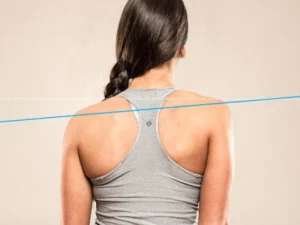 درمان افتادگی شانه