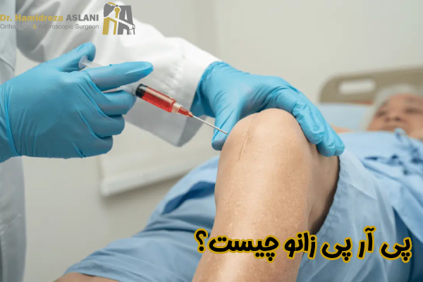 پی آر پی زانو چیست