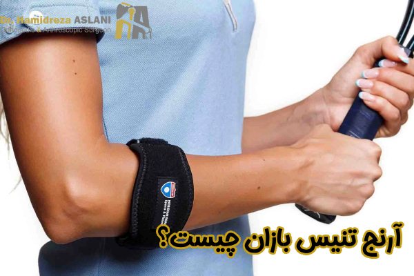 آرنج تنیس بازان چیست؟
