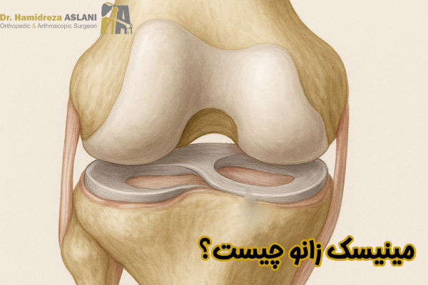 مینیسک زانو چیست