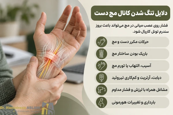 علت تنگی کانال مچ دست