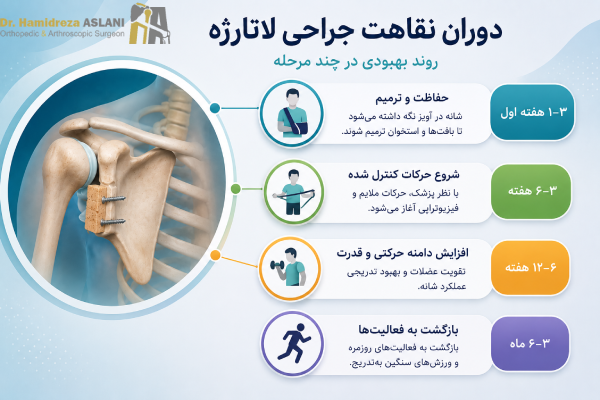 دوران نقاهت جراحی لاتارژه