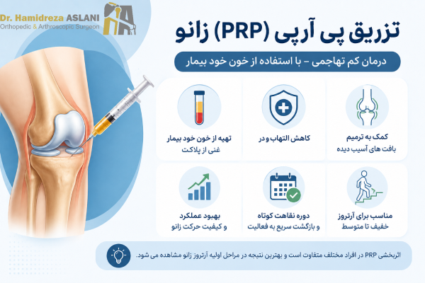 تزریق پی آر پی زانو