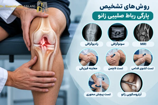 تشخیص پارگی رباط صلیبی زانو