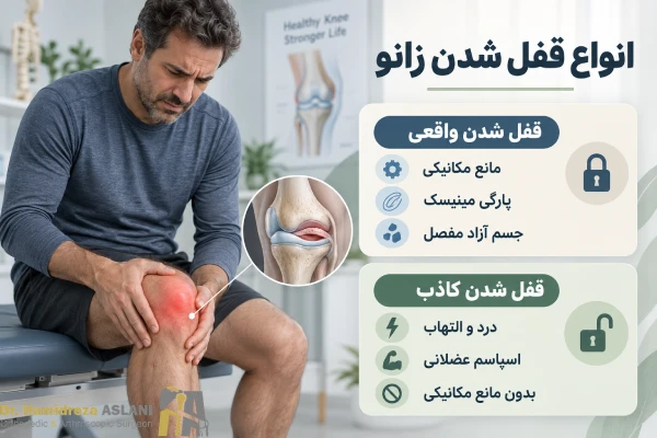انواع قفل شدن زانو