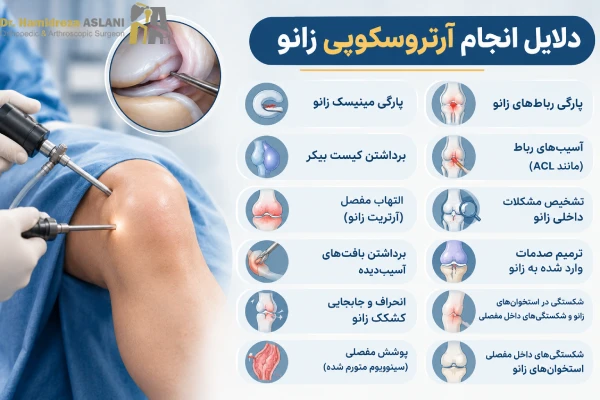 دلایل انجام آرتروسکوپی زانو