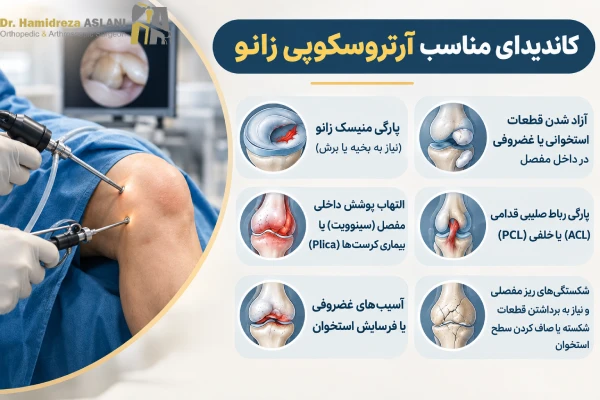 کاندیدای مناسب آرتروسکوپی زانو